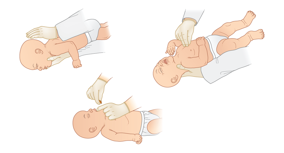 how to unblock airways in babies